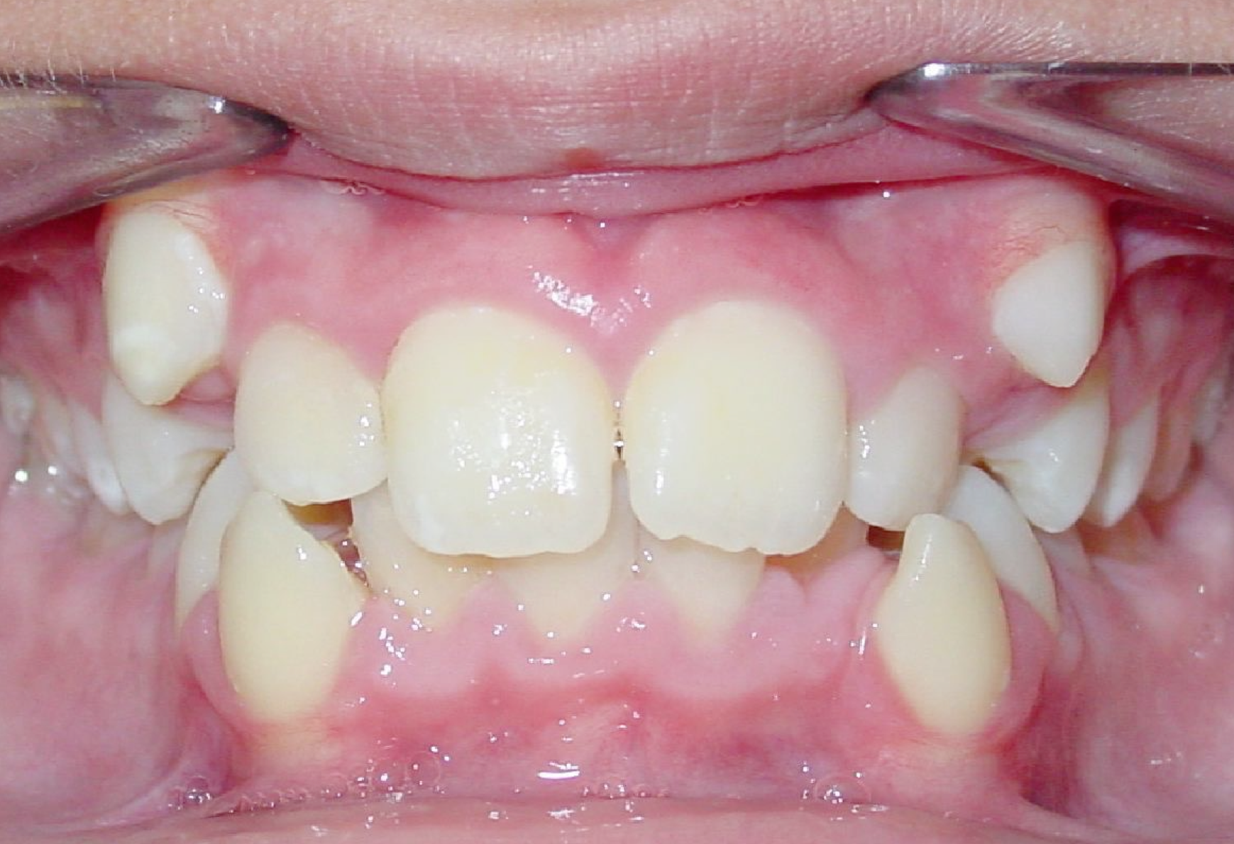 Before